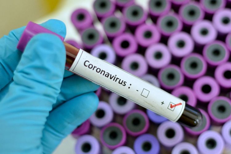 Число инфицированных коронавирусом на Украине выросло на 270 за сутки