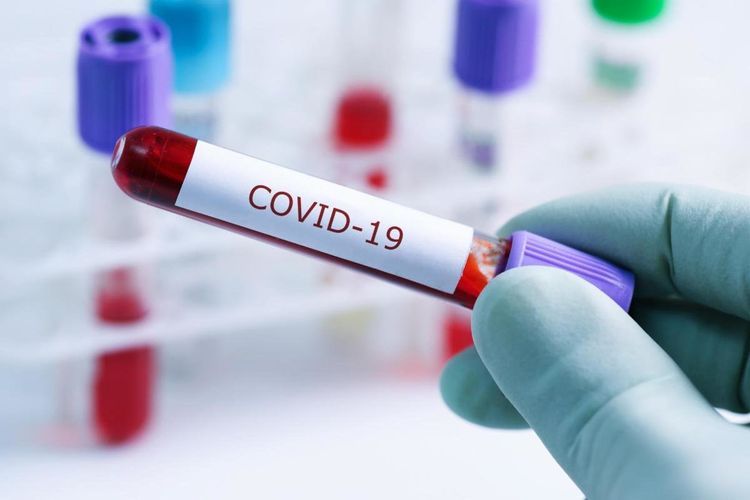 В Великобритании за последние сутки от коронавируса умерли 888 человек