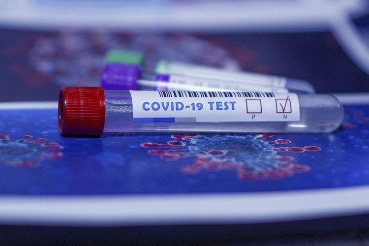 В Азербайджане до сегодняшнего дня проведено 2031308 тестов на коронавирус