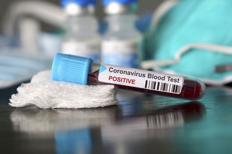 Число умерших от коронавируса в России превысило 5 тысяч