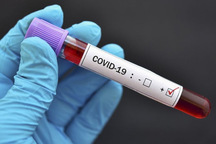     Число зараженных коронавирусом в мире превысило 8 миллионов - ОБНОВЛЕНО