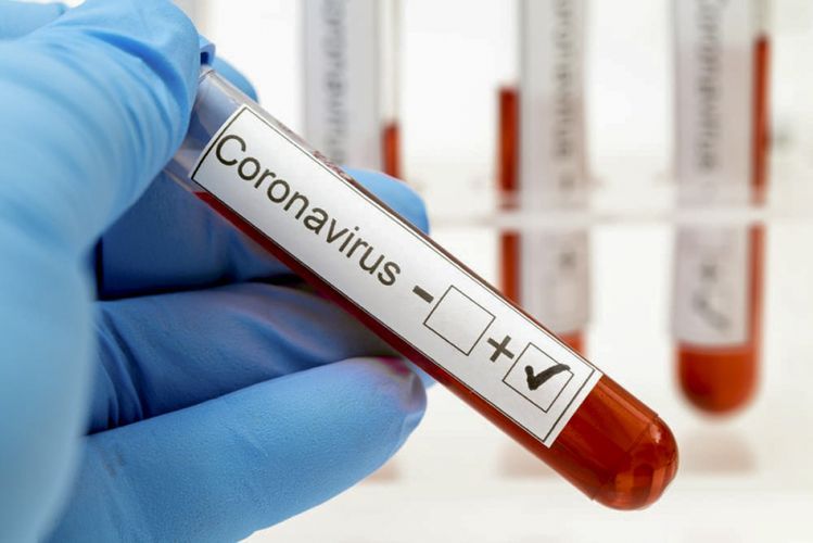  Число инфицированных коронавирусом в Грузии достигло 895 