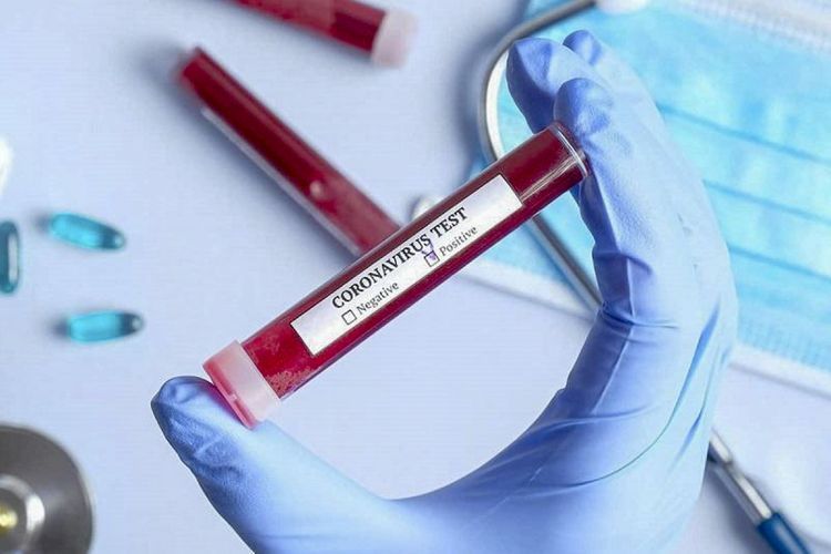 В Иране за последние сутки от коронавируса скончались 147 человек