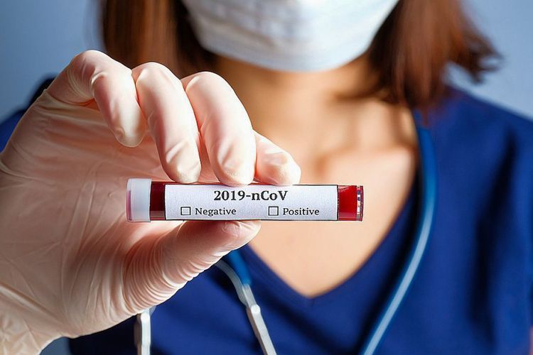 Число инфицированных коронавирусом в Армении достигло 3175, умерли 44 человека