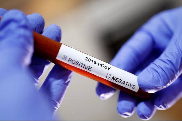 В Сербии выявили более десяти тысяч зараженных коронавирусом