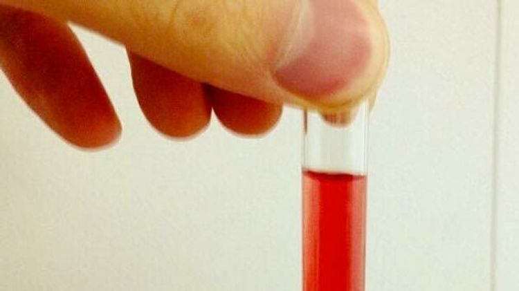 Ученые выяснили происхождение гемоглобина