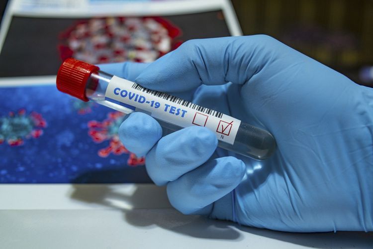 Число умерших от коронавируса в США близится к 100 тысячам 