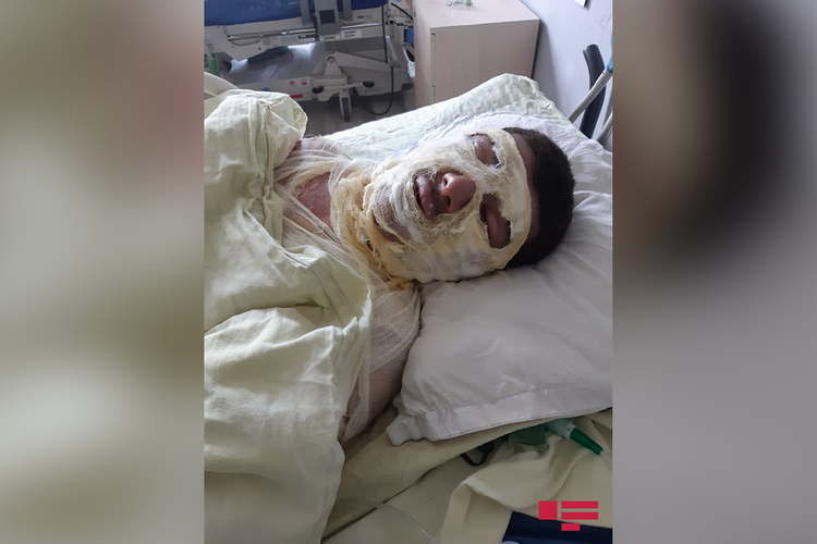 Взрыв в общежитии в Сумгайыте: пострадал один человек - ФОТО