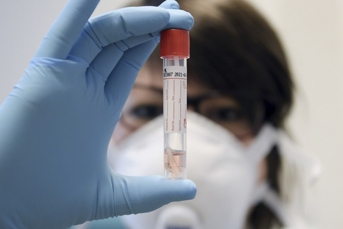 Число заразившихся COVID-19 в Армении достигло 343 506 человек 