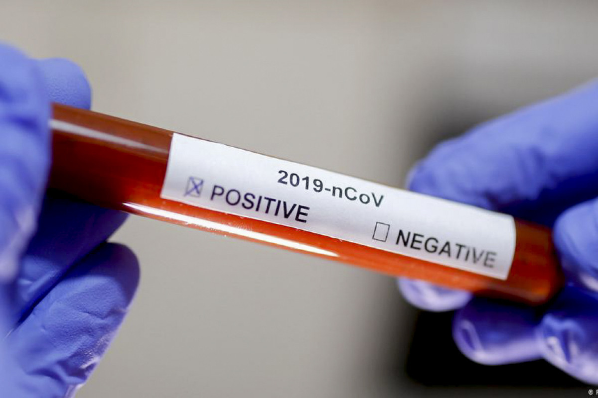 В Иране за последние сутки от коронавируса умерли 184 человека