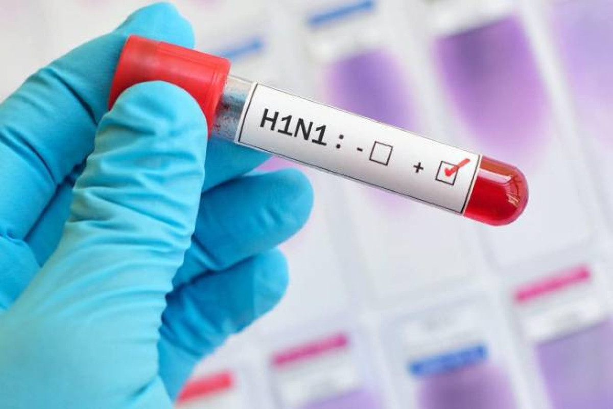 В Армении от «свиного гриппа» умерли два человека
