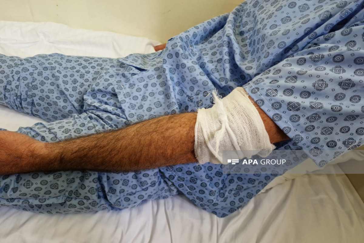 Обнародовано состояние оператора экскаватора, пострадавшего во время обстрела армянами Агдама-ФОТО 