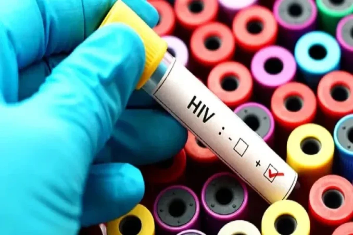 В прошлом году в Азербайджане было зарегистрировано 9,3 тыс. ВИЧ-больных