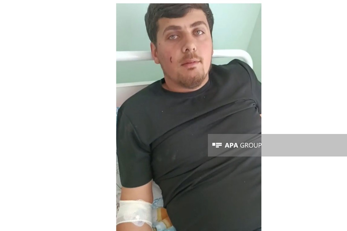 Пострадавший при атаке дрона гражданин Азербайджана: Всё хорошо — <span class="red_color">ВИДЕО
